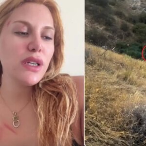 olumu hissettim diyen almeda baylan yasadigi korkunc kazayi anlatti 7HVu5vJm